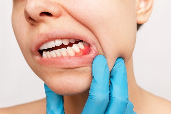 Common Oral Pathologies And How To Treat Them
