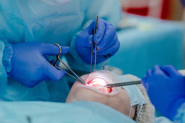 Common Procedures Performed By An Oral Surgeon