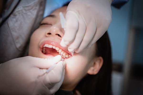 Ask An Oral Surgeon &#    ; Is Wisdom Tooth Extraction Always Necessary?